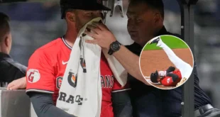 El Béisbolista, David Fry, es Hospitalizado Tras Recibir un Brutal Pelotazo en la Cara a 160 Km/h.