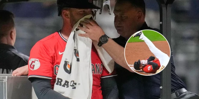 El Béisbolista, David Fry, es Hospitalizado Tras Recibir un Brutal Pelotazo en la Cara a 160 Km/h.