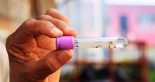 El Ministerio de Salud refuerza medidas ante brotes virales